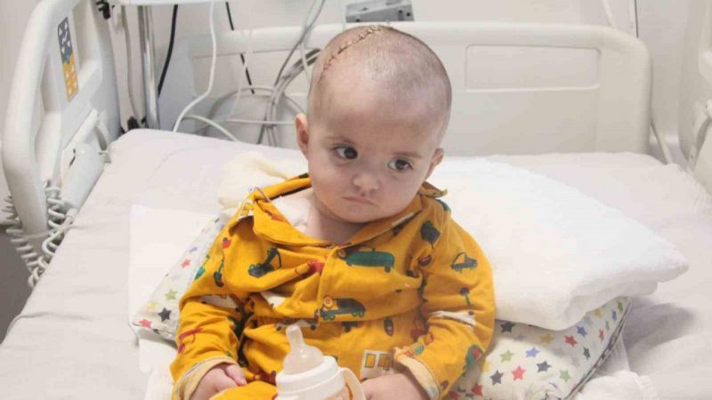 Doktorların Dikkati Beyin Kanaması Geçiren Bebeği Kurtardı