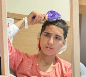 Konya'da Genç Kızın Kopan Saçlı Derisi Başarılı Bir Operasyonla Yerine Dikildi